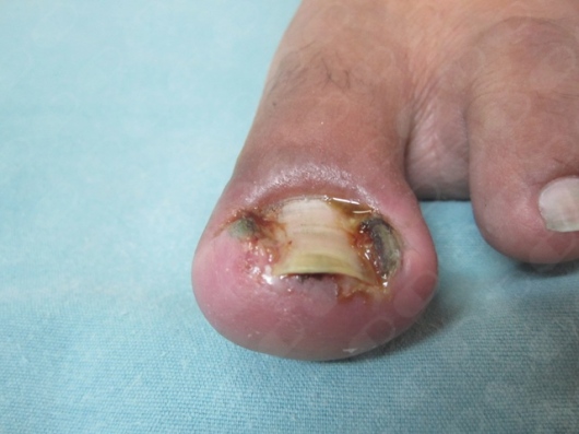 Dr. André Morales Martínez, Dermatólogo, Otras zonas