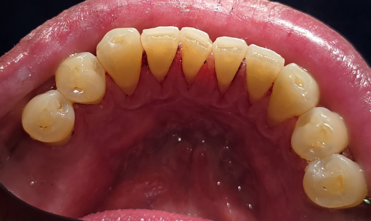 Cirujano Dentista Arturo Lara Endodoncia (Control del Dolor) Lindavista, Otras zonas