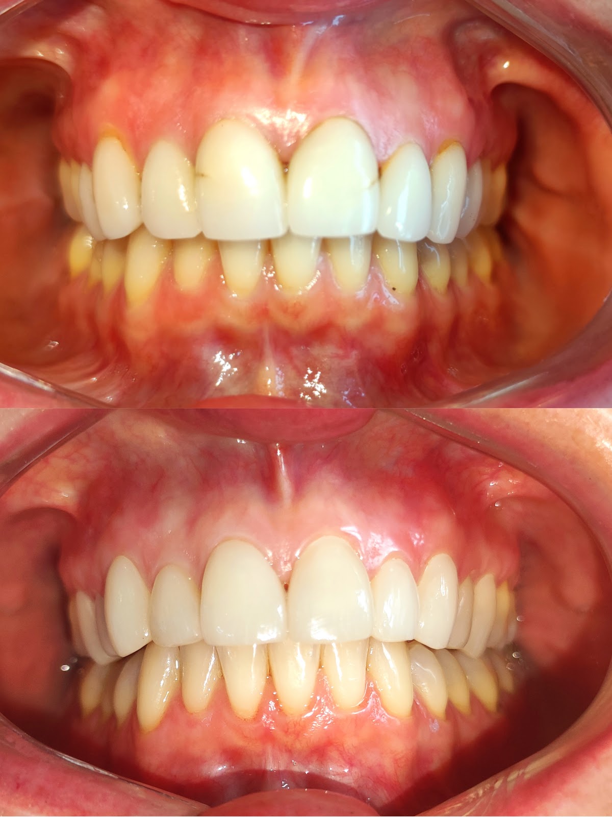 Dentista Cancún HG Odontología Integral, Zona Hotelera