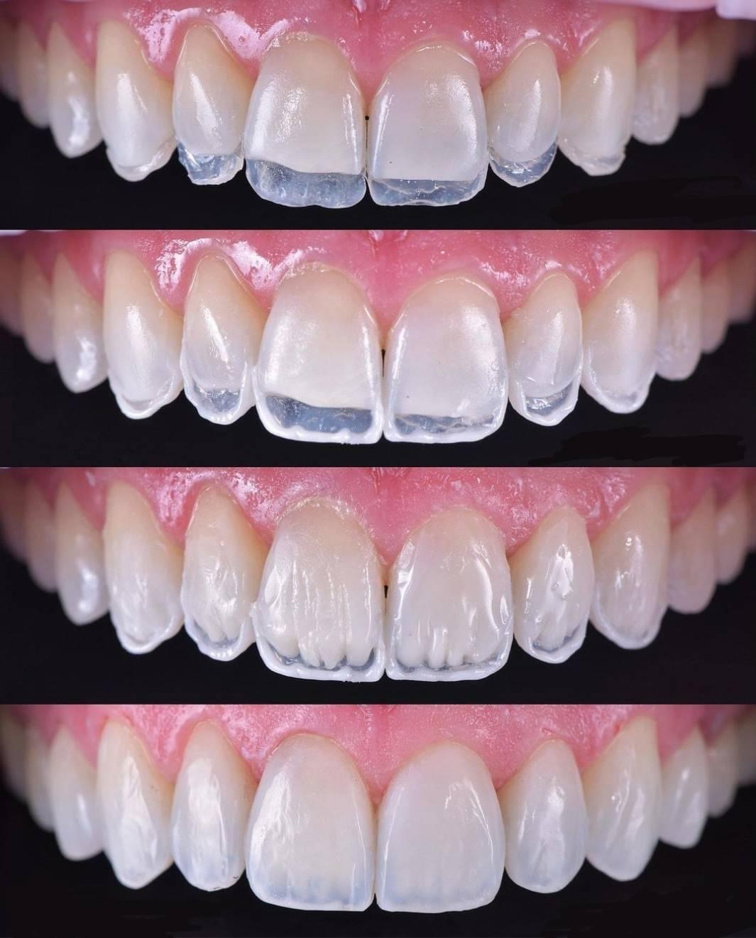 Dental ari, San Pedro Garza García