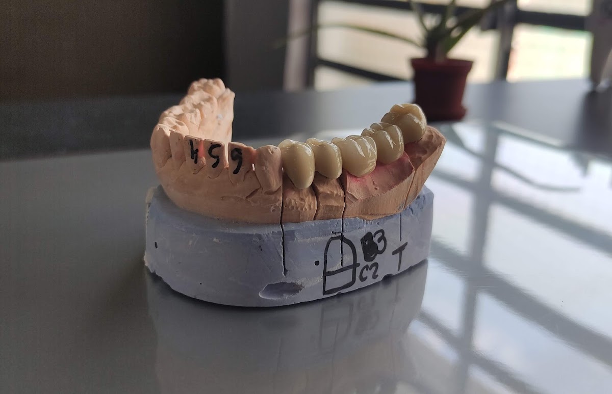 Consultorio dental Mérida | Dentista emergencias, Otras zonas