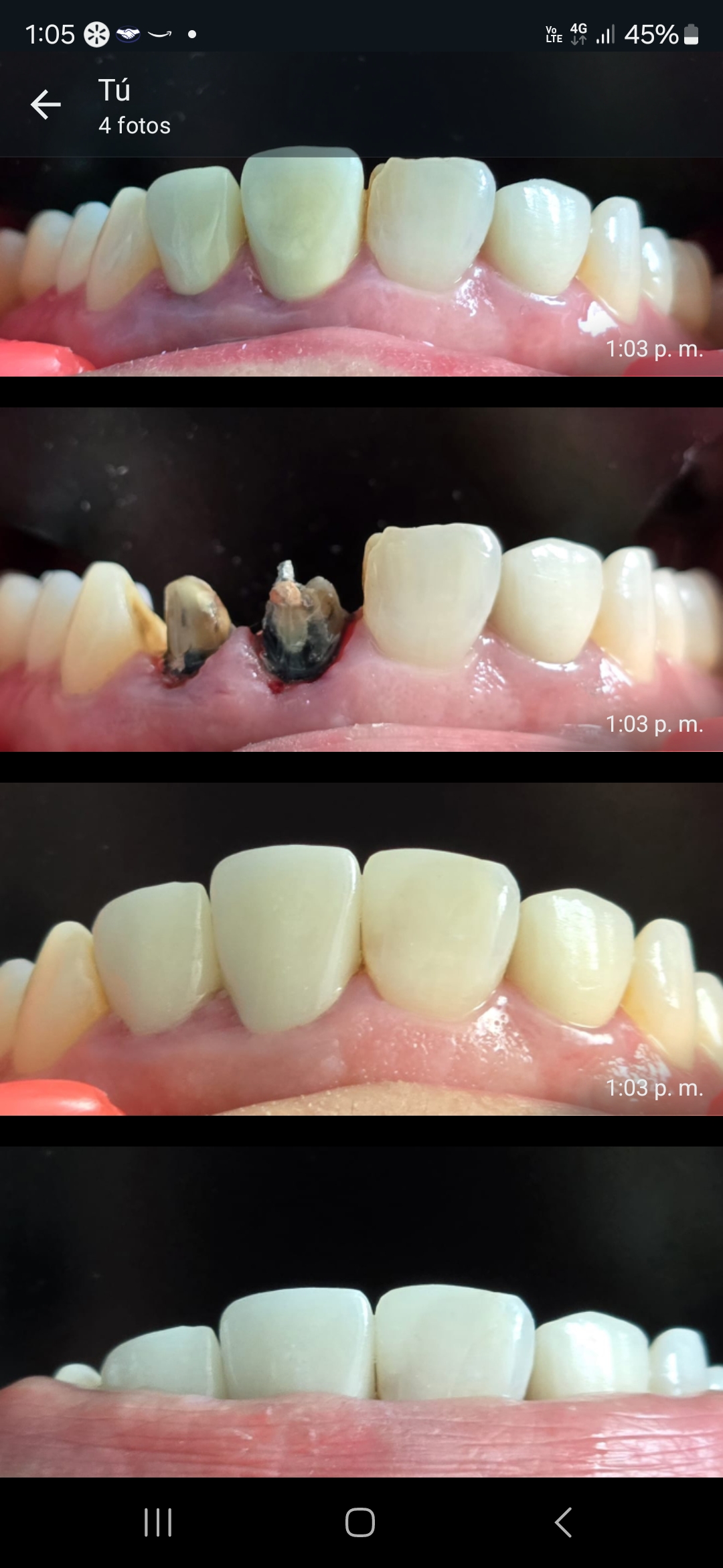 Mass Dental, Otras zonas