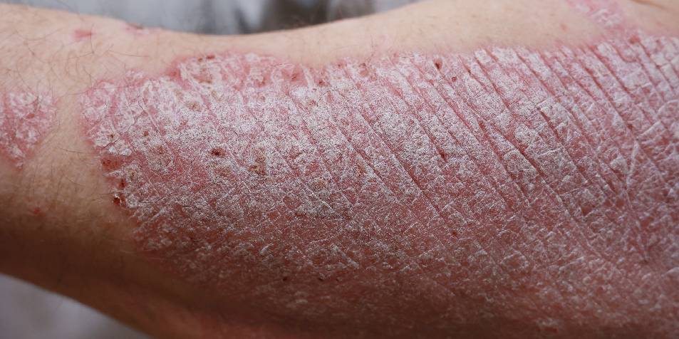 Dr Enrique Ramales y Rossano. Dermatología, Alergia y Cosmiatria Medica, Centro Histórico