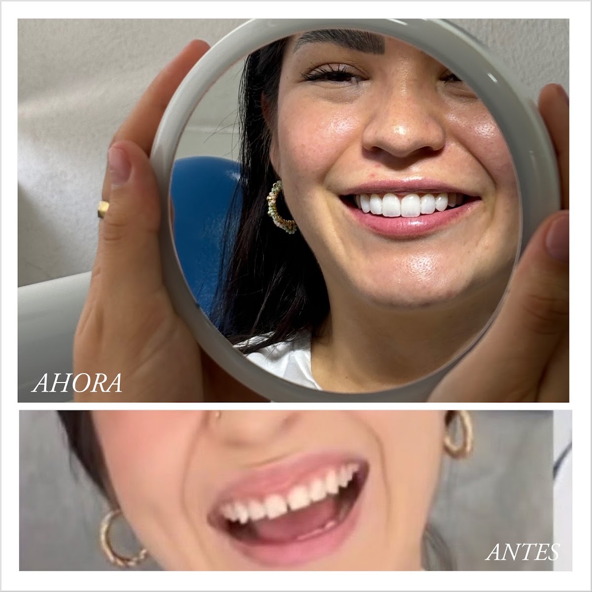 Dra. Mónica Alonso - Odontología Estética Avanzada, Otras zonas