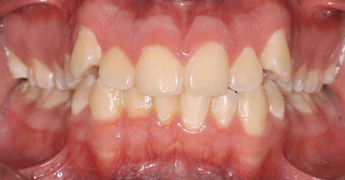 Smart Smile - Clínica Dental, Altabrisa