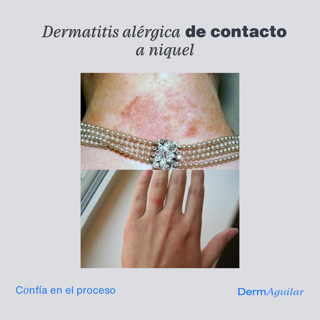 Dermaguilar, Otras zonas