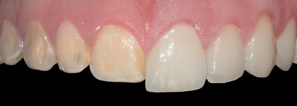 GRUPO Dental ANTEA, Jurica