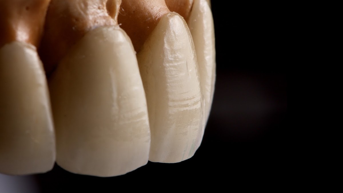 Dr. Ricardo Lemus, Rehabilitación Oral Estética e Implantología Dental, Otras zonas