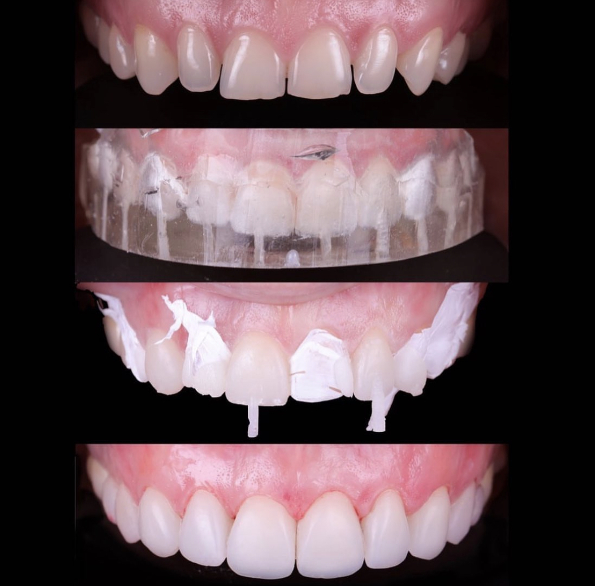 Dental Laser Juriquilla, Juriquilla