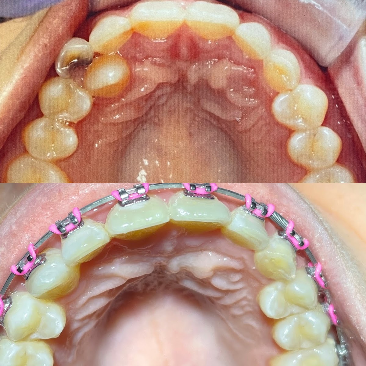 Ortodoncista Dentista Guadalajara, Zapopan