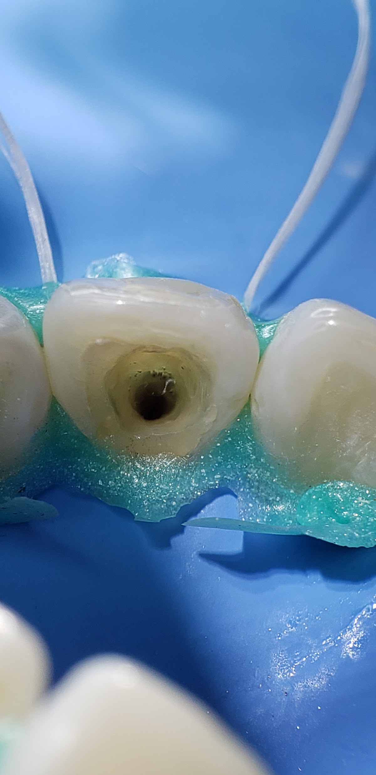 Endodoncia Condesa, Condesa