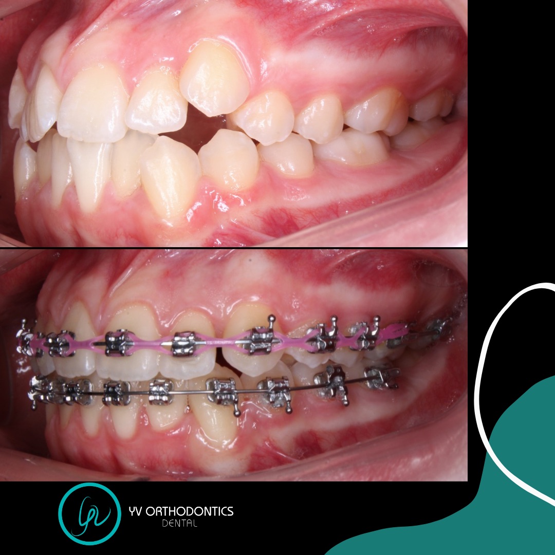 Dental YV Orthodontics, Zona Río