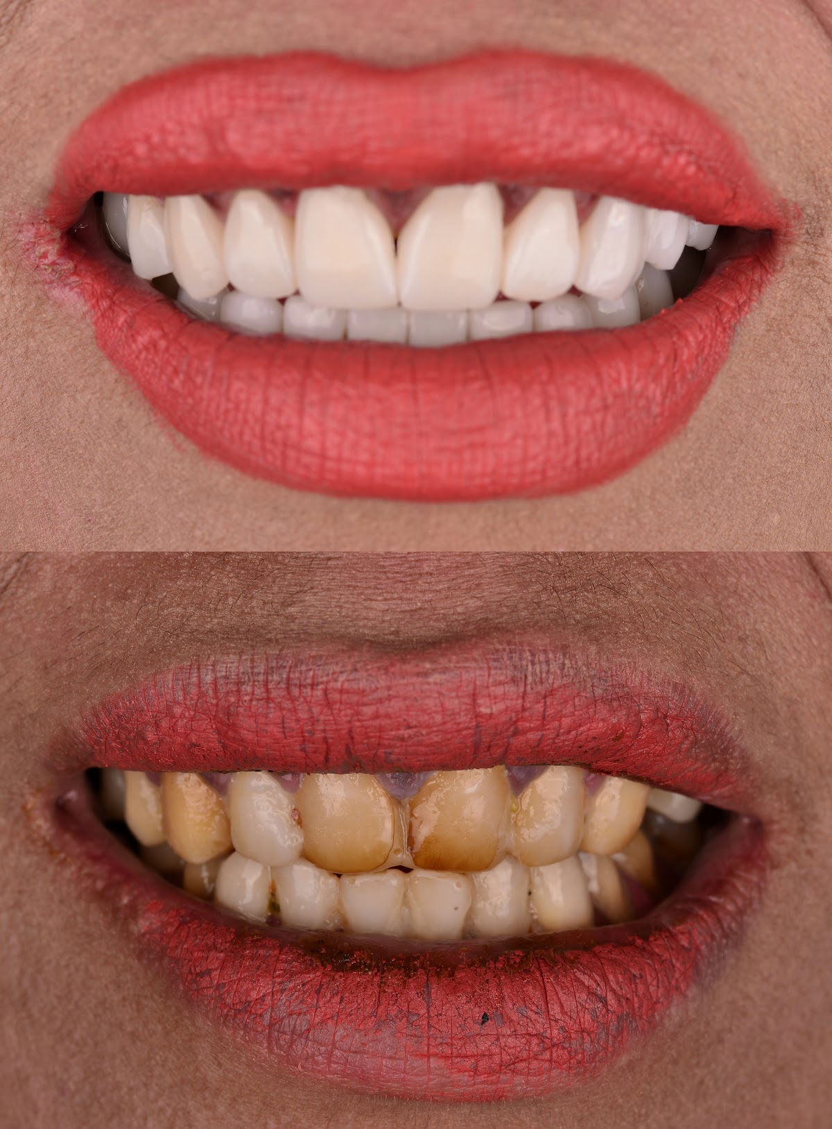Unique Dental Clinic Cancun MX, Zona Hotelera