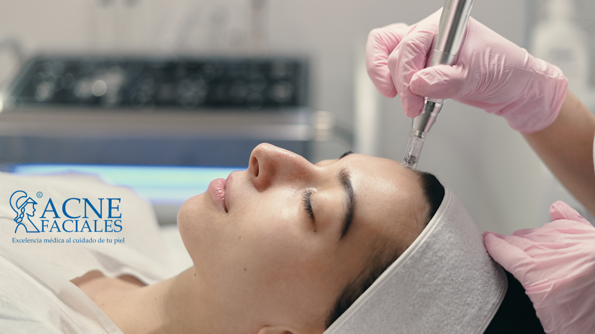 Acne Faciales - Roma Norte, Roma