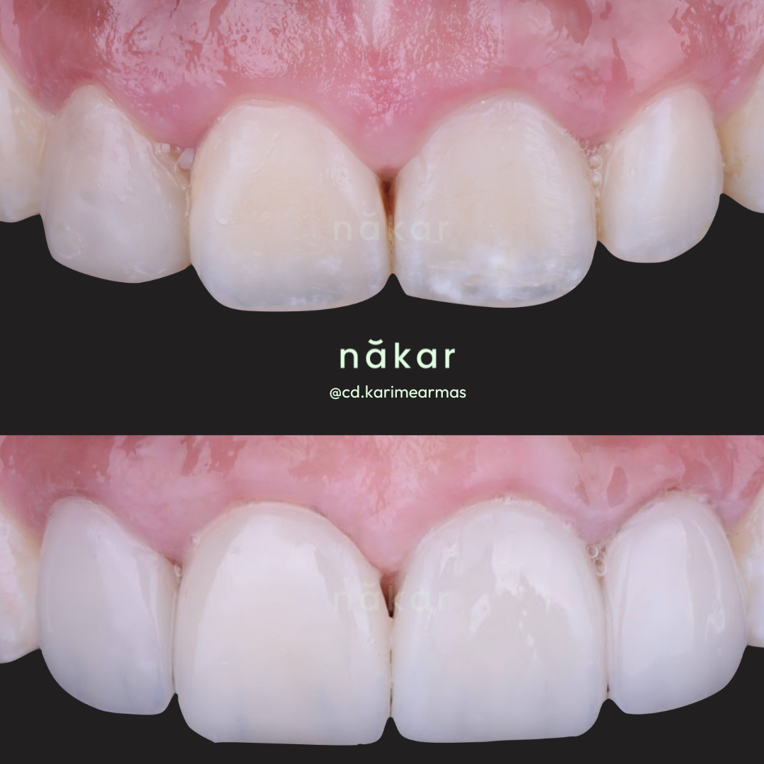 Dentista Karime Armas - Nákar Odontología Polanco CDMX, Polanco
