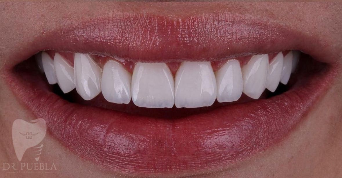Consultorio Dental Dr. Puebla, Otras zonas