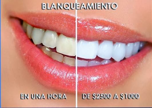 Dentistas en Puebla Clinica Dental Spota, Cholula
