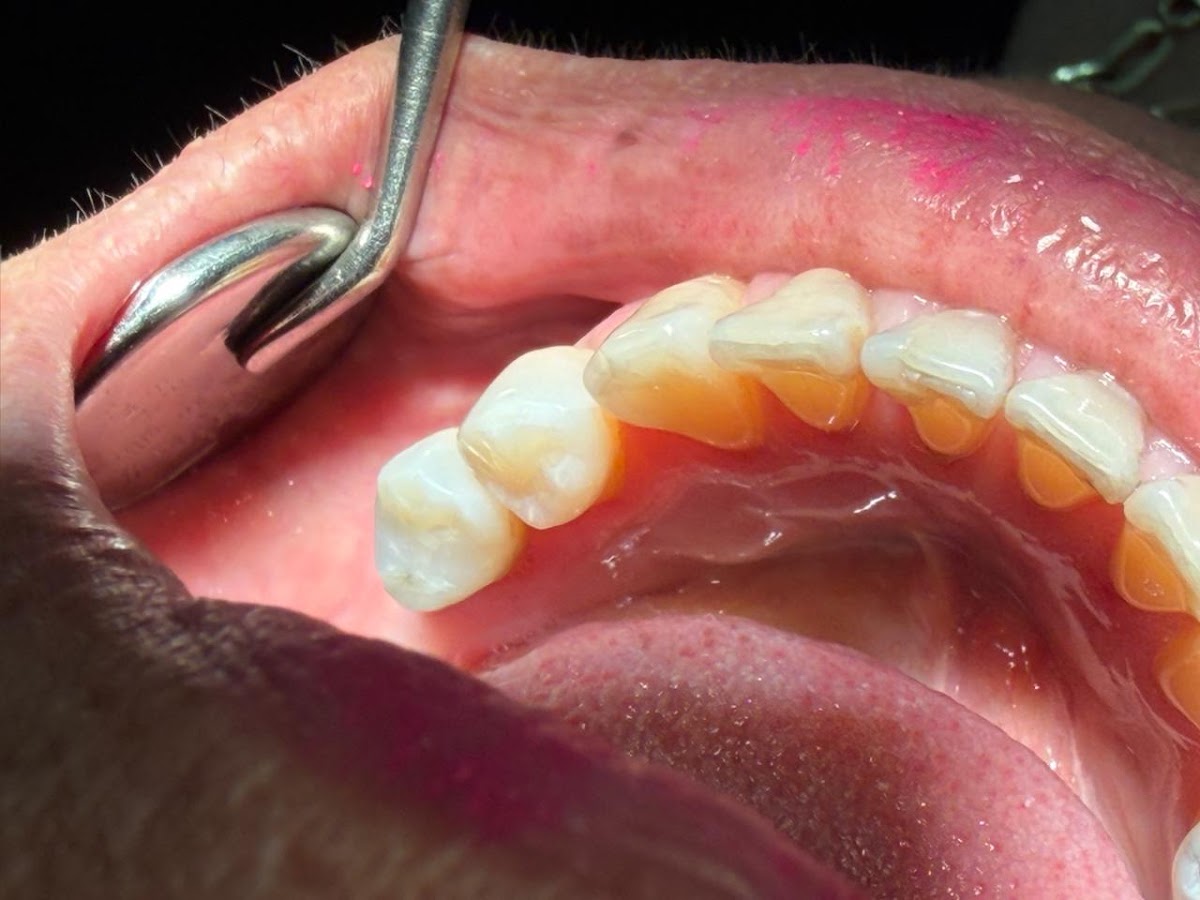 Dental Dentauro, Zona Río