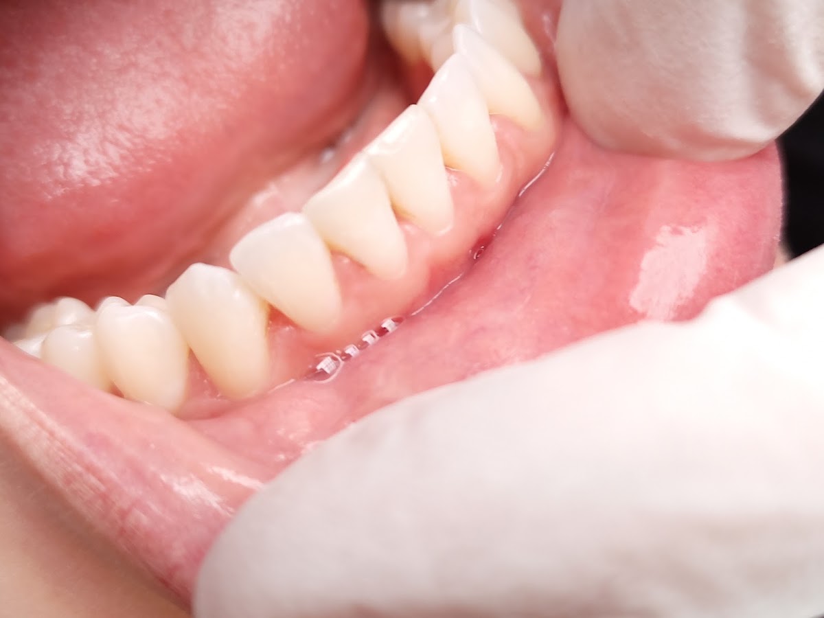 Clínica dental T-Care, Campestre