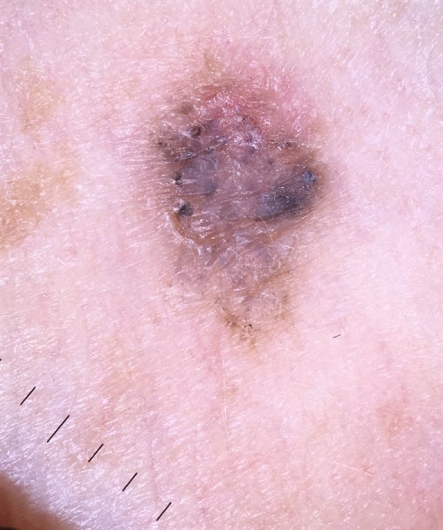 Dra. Virginia Susana Luna Magaña, Dermatólogo, Zona Río