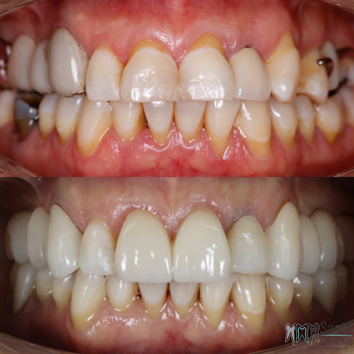 DENTiOSS, Otras zonas
