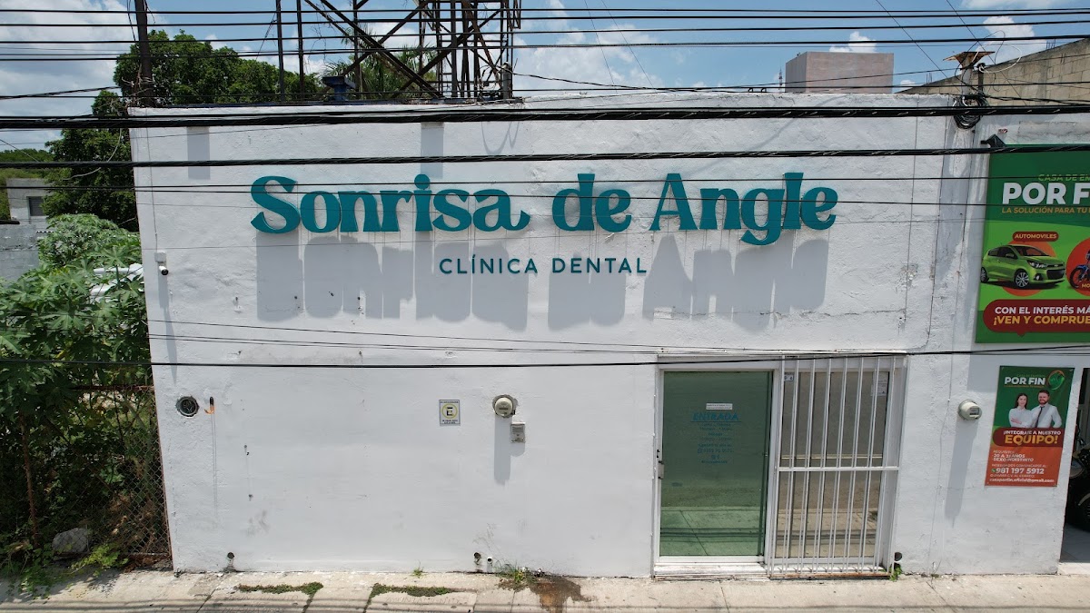 Sonrisa de Angle Circuito Colonias, Otras zonas