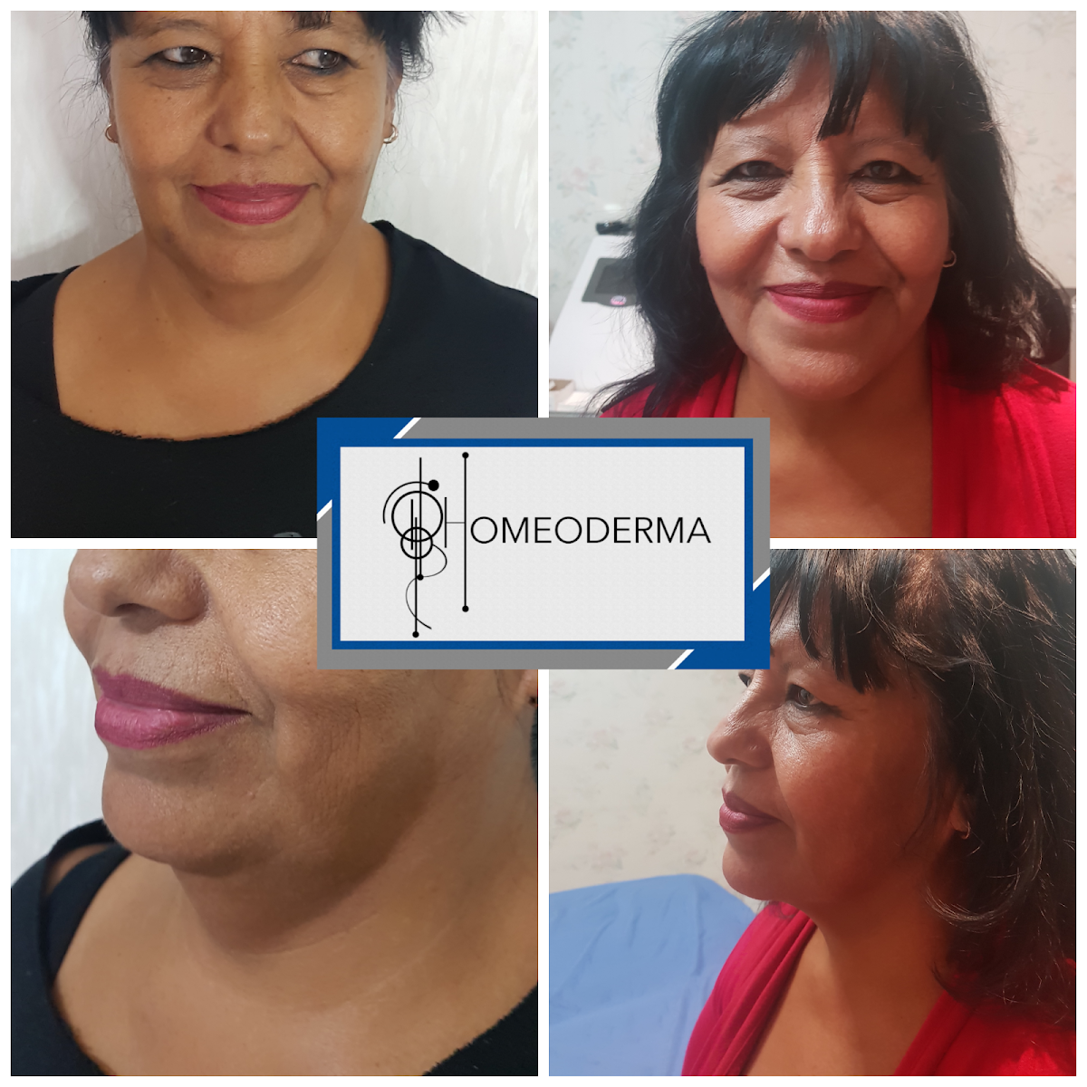 Homeoderma Aesthetic Medicine, Sur