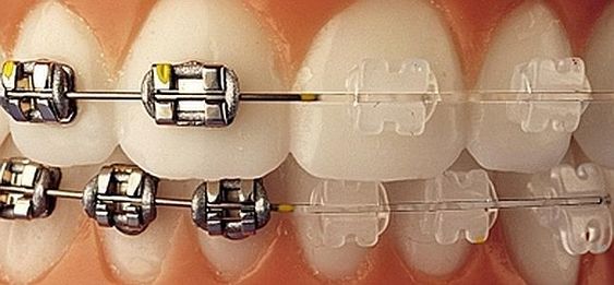 Dentista en Polanco Dr. Alfredo Morales Viramontes, Polanco