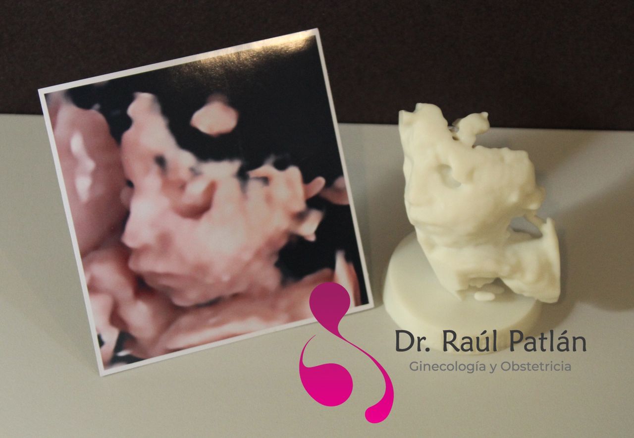 Dr. Raul Alejandro Patlan Montalvo, LEON