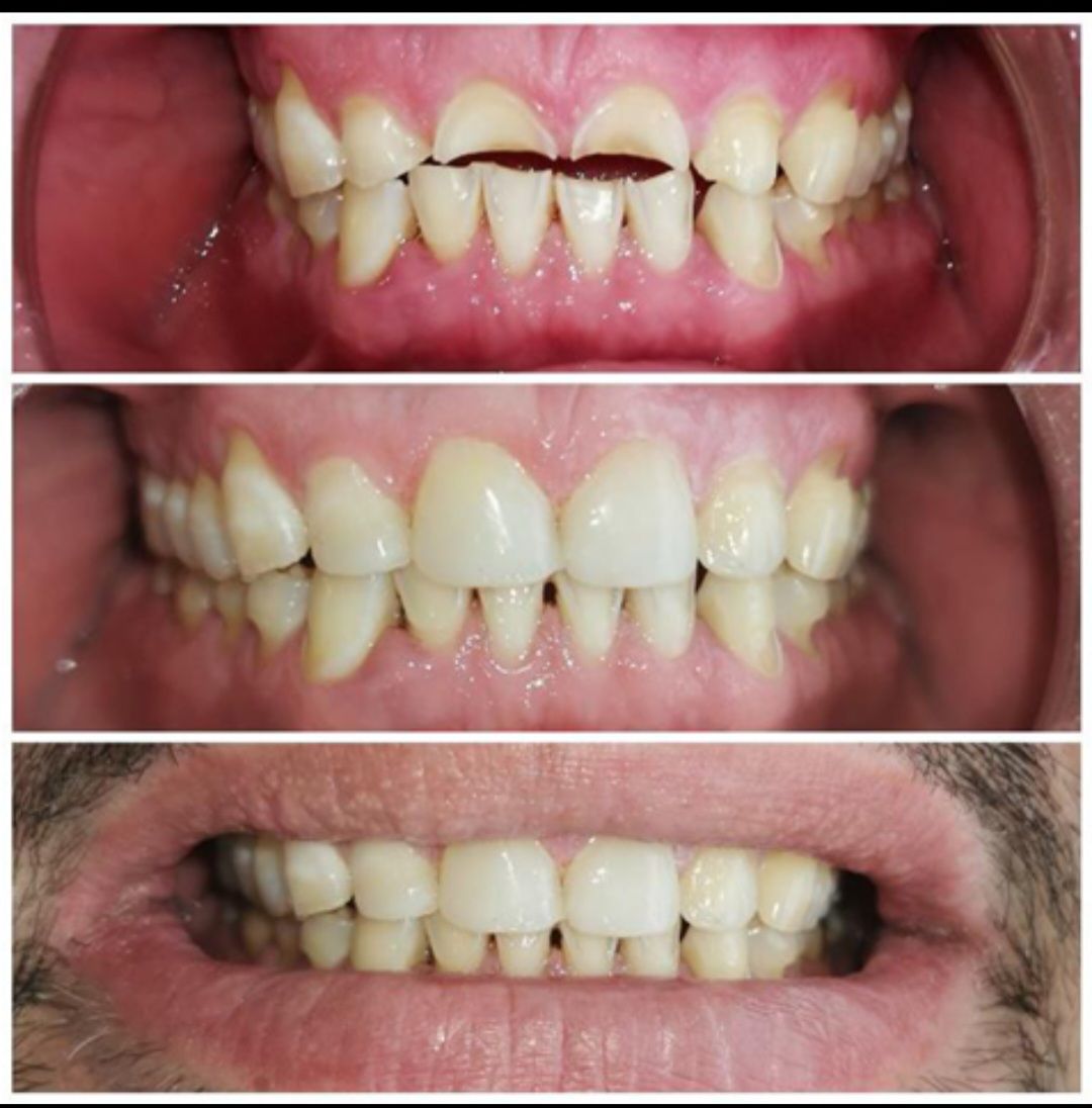 Endodoncista, TIJUANA