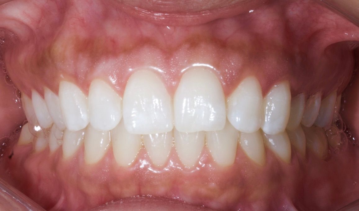Blinken dental studio, LEON