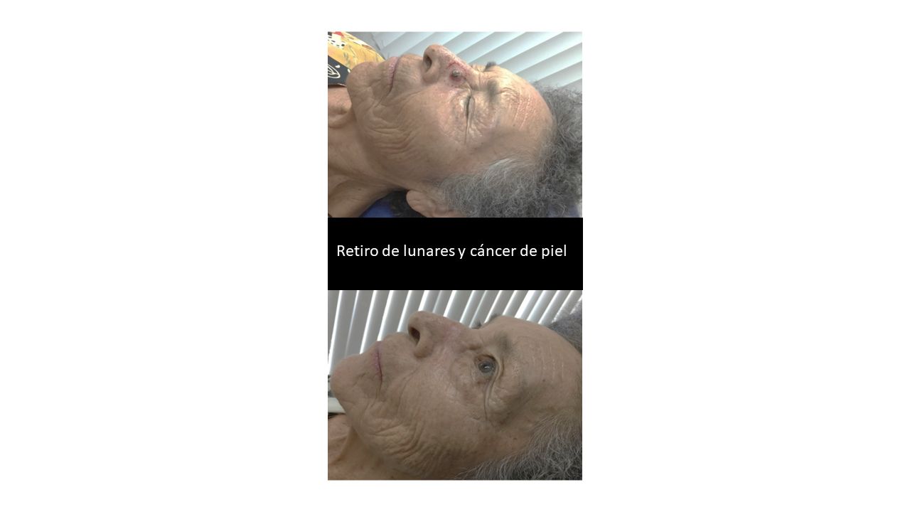 Médica Nápoles, CDMX