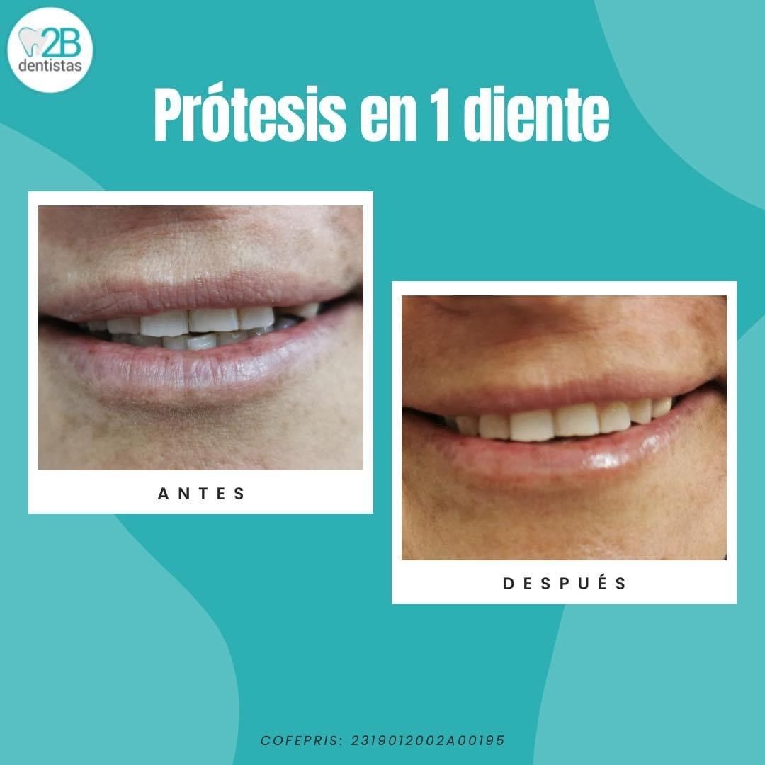 2b dentistas Dra Erika, Monterrey