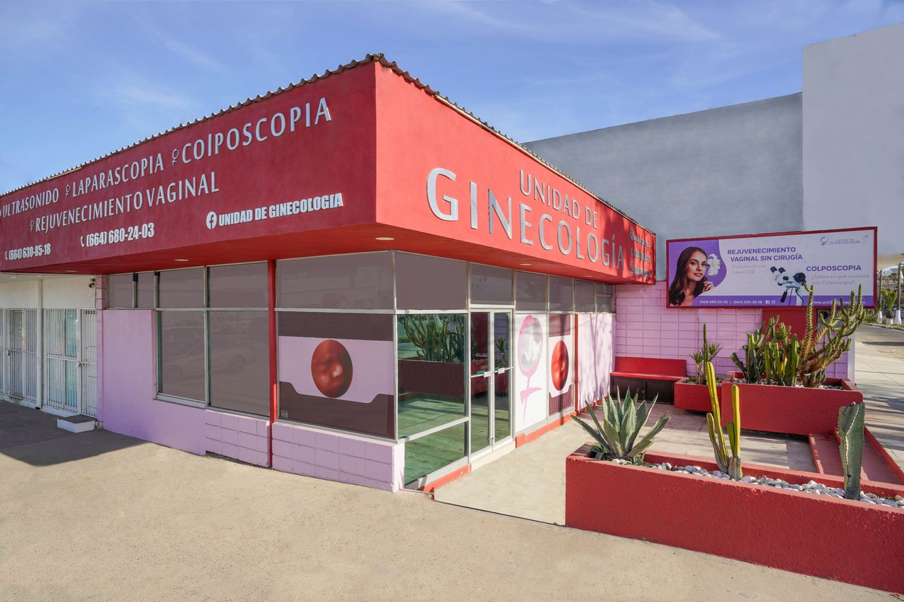 Unidad de Ginecología, TIJUANA