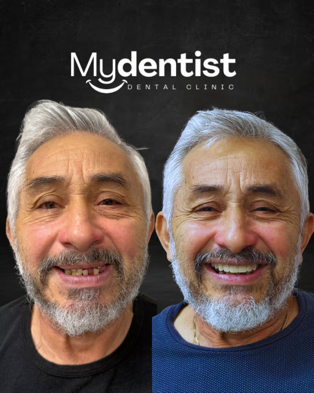 MYDENTIST, CANCUN