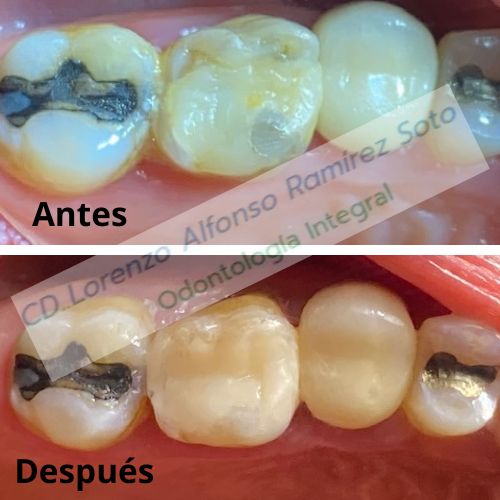 Dr. Lorenzo Alfonso Ramìrez Soto, Roma-Condesa