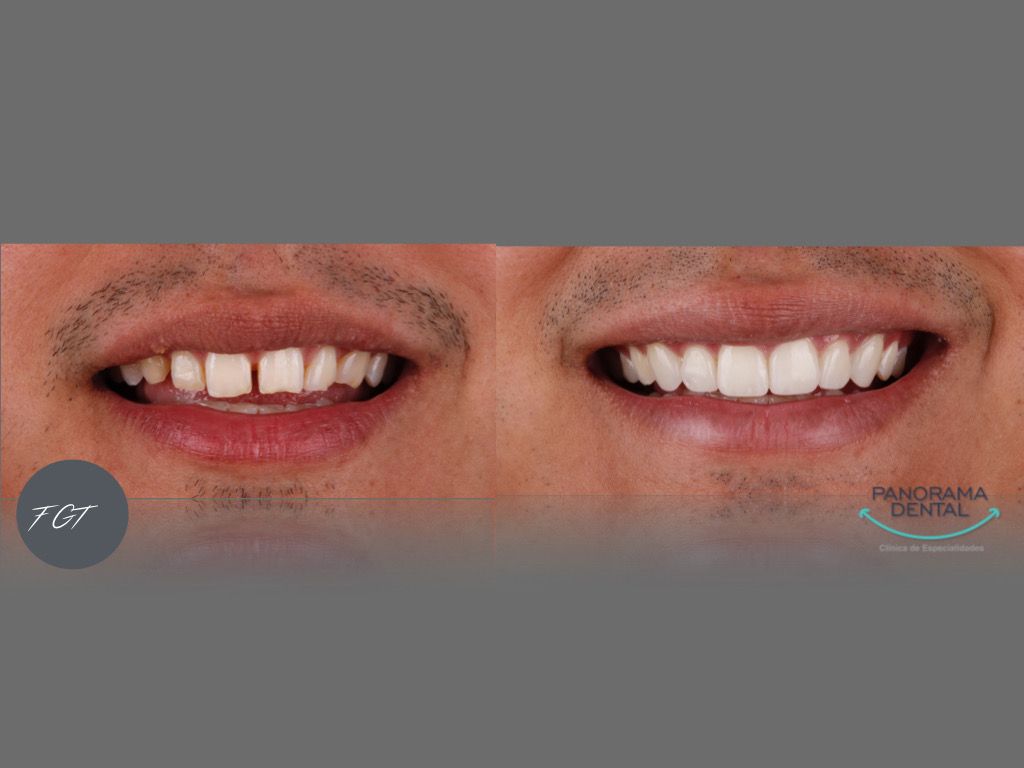 Panorama Dental Leon, LEON