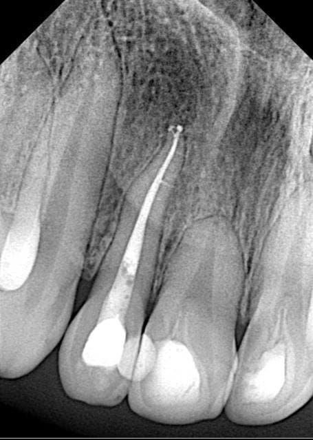 DENTAL ROOTS, LEON