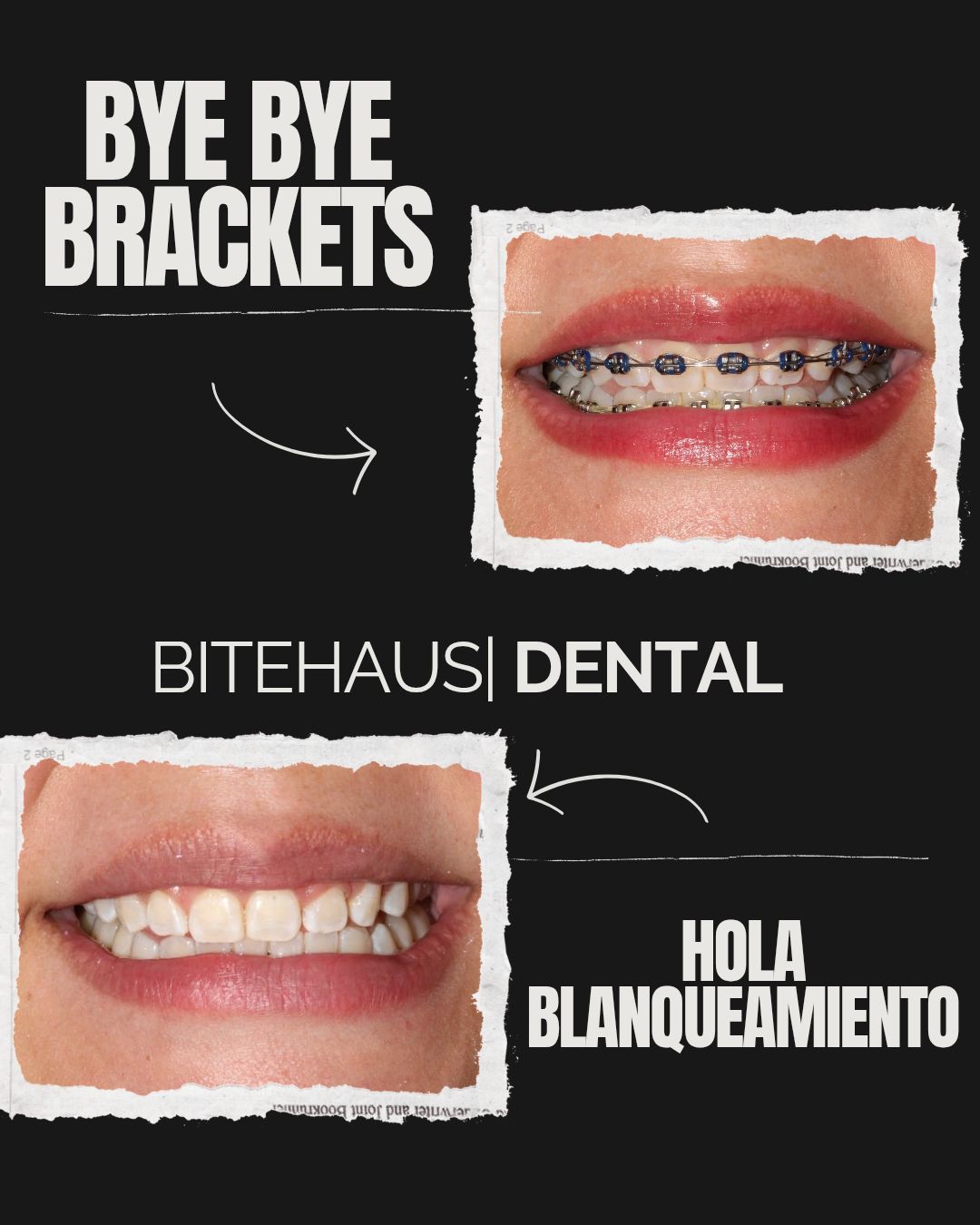 Bitehaus Dental Consultorio Dental, Monterrey