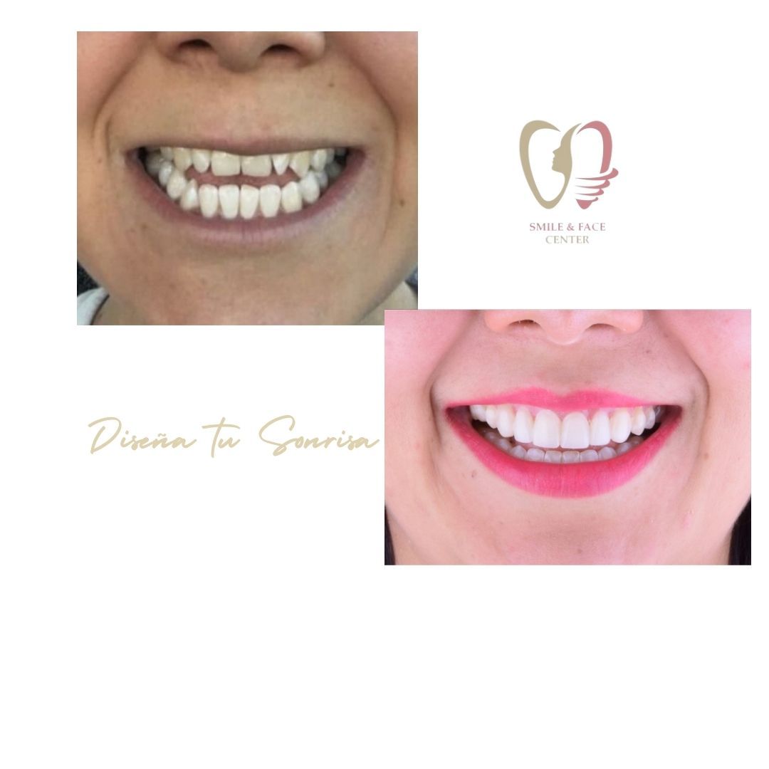 Smile & Face Center, AGUASCALIENTES