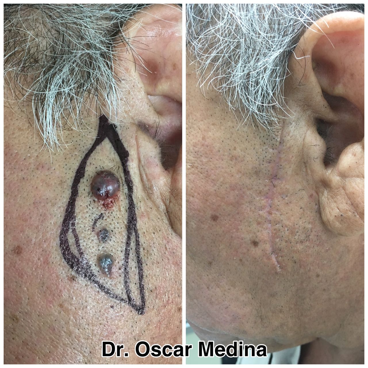 Dr. Oscar Alejandro Medina Navarro, MERIDA