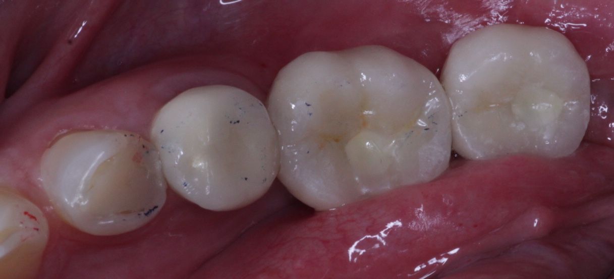 Sm4 Smile Method For All, TIJUANA
