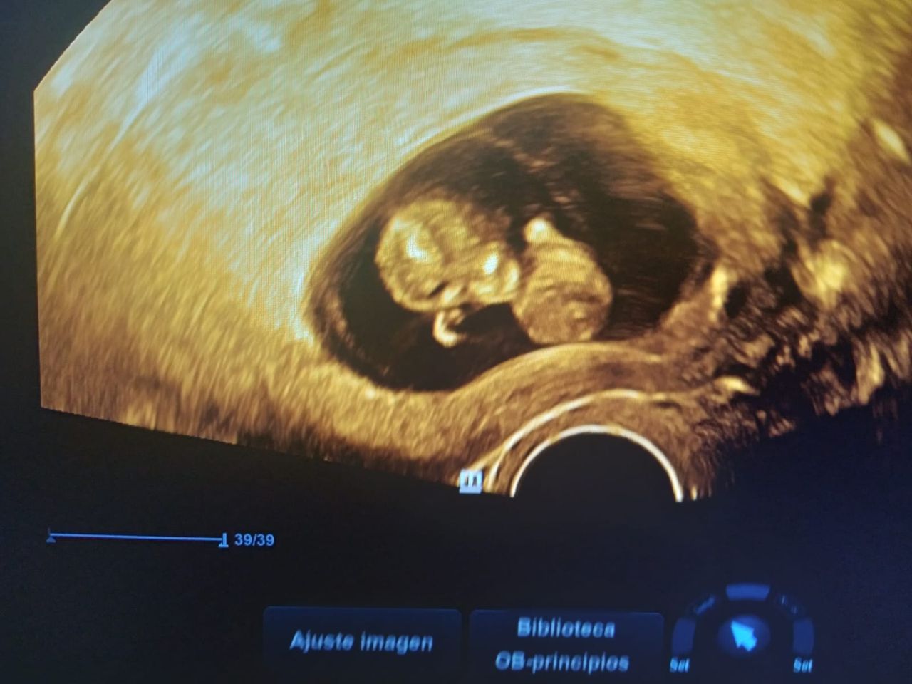 Dr. Fredy Pineda Bustos, AGUASCALIENTES